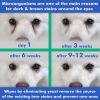 Pet Eye Wipes for Dogs and Puppies 100 Count Natural and Aromatherapy Medicated Removes Dirt Crust and Discharge Soft and Gentle